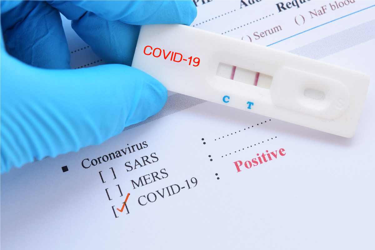 COVID-19 Testing and Positive Test Results